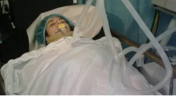Un dominicano muerto y una venezolana en estado crítico por accidente en Boca Chica