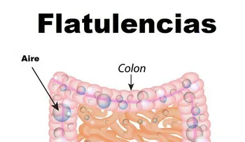 Flatulencias, 7 sorprendentes beneficios de tirarse gases