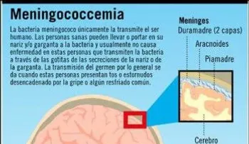 Muere menor por meningococemia; hay otros tres infectados 