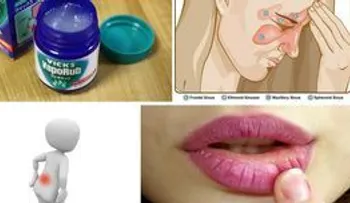 Dile bye bye a las estrias y hongos de las uñas con el VICK VAPORUB: 13 usos increíbles