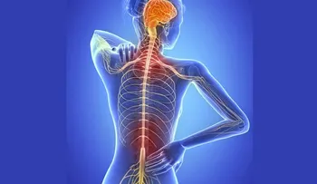México tiene disponible tratamiento para esclerosis múltiple