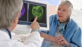  Eliminan en ratones la formación de placas amiloide, causantes del alzhéimer 