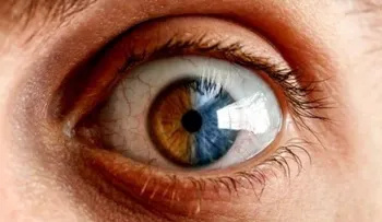 Los cambios de color en tus ojos revelan posibles enfermedades
