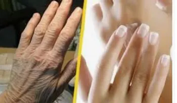 Las arrugas desaparecerán de tus manos en solo 15 minutos
