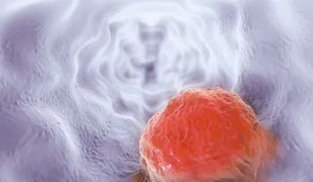 Un medicamento (fostamatinib) que ya está en venta, evitaría la propagación del cáncer