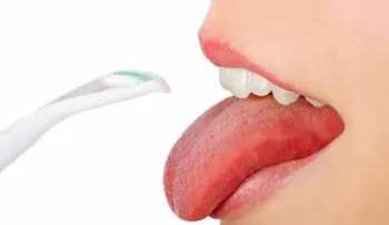 5 trucos para evitar el mal aliento sin salir de casa