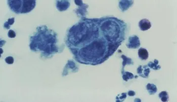 Más cerca de una vacuna contra el herpes genital