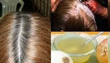 Este jugo de cebolla elimina todas las canas de tu cabeza