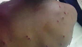 Juez libera agresor de estudiante fue impactada con perdigones