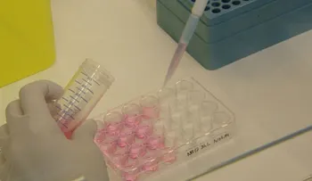 Video:Tuberculosis, que es y como prevenirla