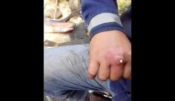 Le rogaron que fuera al médico y no quiso ir, y reventó esto a sangre fría (VIDEO)