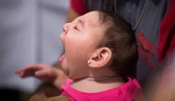 Bebés con zika tendrán déficits cognitivos al crecer, prevén científicos 