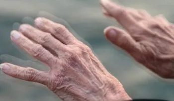 Universidad de Japón realiza primer trasplante de células madre para tratar Parkinson