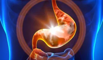 Estas son las 10 posibles causas que generan gastritis