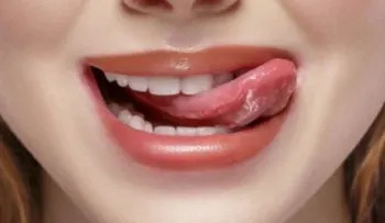 ¿Qué dice tu lengua sobre tu salud? ¡Entérate!