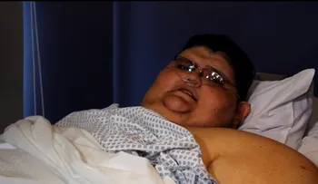 "Quiero estar bien y salir adelante": la nueva vida del hombre más obeso del mundo