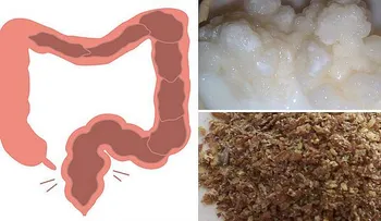 Impactante: podrías tener 33 libras de tóxinas en tu cuerpo!â?¦ Eliminalo !!â?¦ 