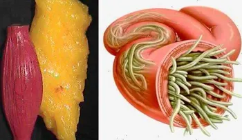 2 ingredientes para vaciar los depósitos de grasa y parásitos del cuerpo como si nada