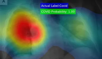 Un científico crea poderoso software que detecta el coronavirus en segundos y con un 98% de precisión 