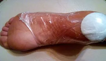 10 días serán suficientes con este remedio para quitar por completo los talones agrietados 