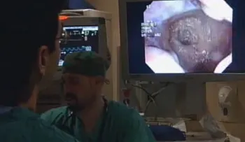 Hallan relación entre la grasa y el cáncer