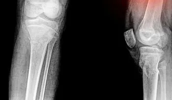 Científicos revelan qué sexo padece más el dolor 