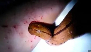 Alimenta a sanguijuela con su sangre (Video)