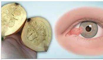 Receta para curar la visión definitivamente. Bébelo al irte a dormir y observa como en la mañana tendrás 50% más de vista