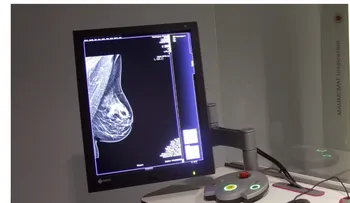 Día Mundial Cáncer de Mama: prevención y detección