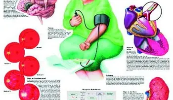 Principales causas de hipertensión arterial secundaria en ancianos