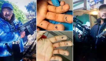 Asesinan capo mexicano "El Kalimba, mientras se sometía a una cirugía estética 