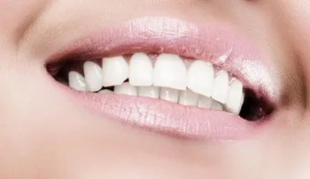 Remedios caseros efectivos para blanquear los dientes; No 1, 2, 3 y 4