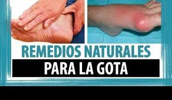 Anótalo estos 5 remedios naturales para combatir la gota 
