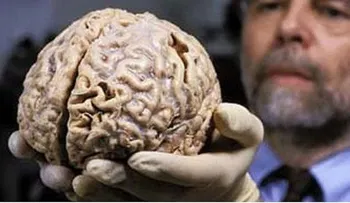  El fenómeno del déjà vu es un "truco del cerebro" y no algo sobrenatural 