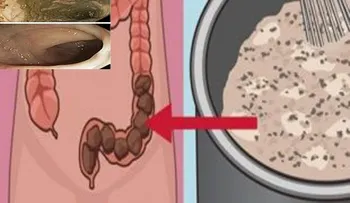 Limpiar el colon y pierde 10 kilos en tan sólo 3 semanas con este poderoso remedio natural!