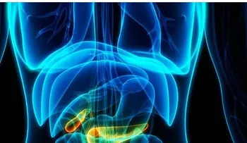 Signo que le reveló un cáncer de páncreas mortal