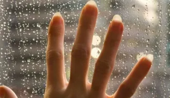 ¿Eres alérgico al agua? Cómo detectarlo y sobrevivirlo