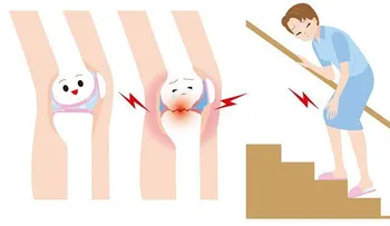 Fortalecer los huesos y tratar el dolor de articulaciones con bebida de 4 ingredientes