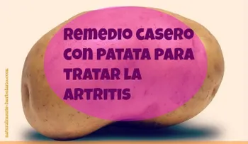 37 remedios para la artrosis y recomendaciones