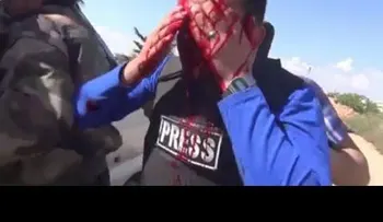 Periodista herido de gravedad mientras grababa reportaje (advertencia: VIDEO +18)
