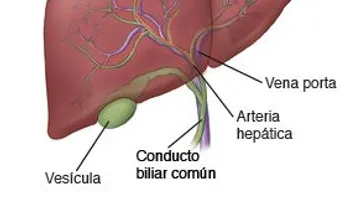 La comida procesada, el alcohol, azúcar y la carne roja dañan directamente el hígado 
