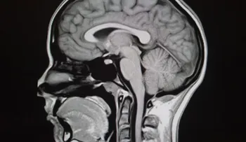 La ciencia de las ideologías en el cerebro humano