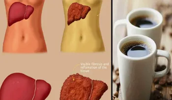 Cuida tu hígado, de enfermedades como el cáncer, consumiendo café