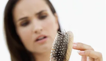 Cuatro motivos por los que se cae el cabello
