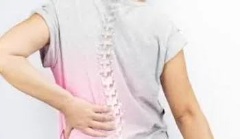  Desarrollan polímeros para mejorar recuperación de lesión medular 