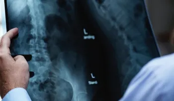 Curiosos objetos que son "olvidados" por pacientes dentro de sus cuerpos