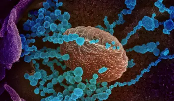 Una alentadora noticia para el mundo. Hallan nueva forma de transmisión COVID-19, que daría pistas de cómo combatir el coronavirus