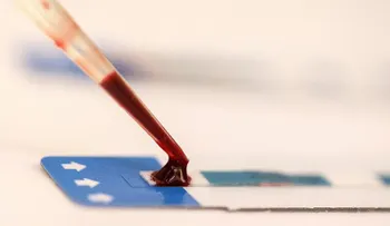 Un tercer paciente se habría curado del VIH con trasplante de médula ósea