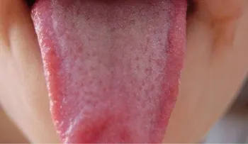 Ponle atención a tu lengua: 9 cosas que intenta decirte sobre tu salud