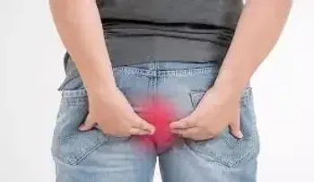 Imperdibles consejos para prevenir y tratar las hemorroides 